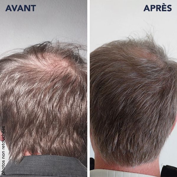 100% DE SATISFACTION